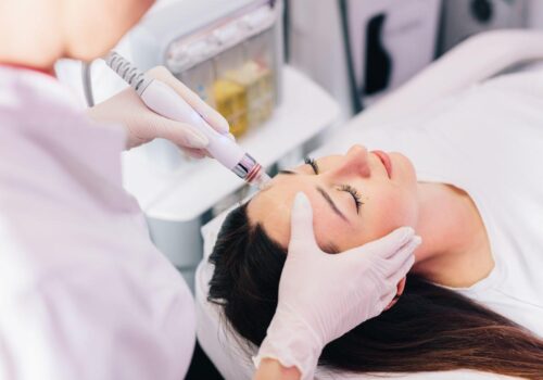 Lohnt sich HydraFacial? Die wichtigsten Fakten und Meinungen